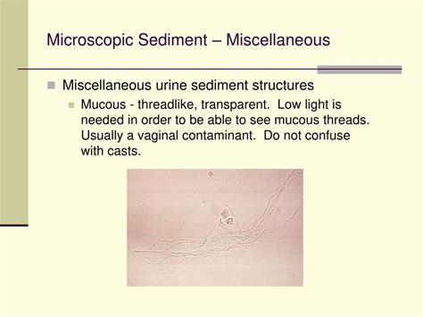 mucus threads in tagalog|Translate mucus threads in Tagalog with examples .